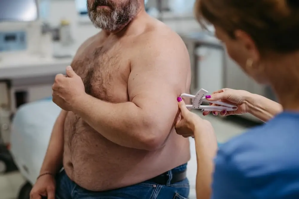 female doctor measuring body fat of overweight pat 2024 10 18 09 04 04 utc